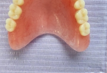 Medic Bun Pitesti Ortodontie si Implantologie Dentara Pitesti - Clinica Dr. Gupta