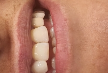 Medic Bun Pitesti Ortodontie si Implantologie Dentara Pitesti - Clinica Dr. Gupta