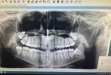 Medic Bun Pitesti Ortodontie si Implantologie Dentara Pitesti - Clinica Dr. Gupta