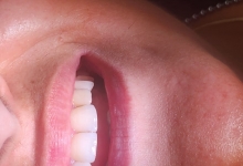 Medic Bun Pitesti Ortodontie si Implantologie Dentara Pitesti - Clinica Dr. Gupta