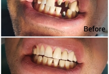 Medic Bun Pitesti Ortodontie si Implantologie Dentara Pitesti - Clinica Dr. Gupta