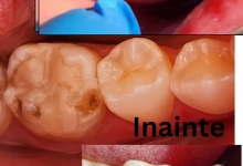 Medic Bun Pitesti Ortodontie si Implantologie Dentara Pitesti - Clinica Dr. Gupta