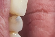 Medic Bun Pitesti Ortodontie si Implantologie Dentara Pitesti - Clinica Dr. Gupta