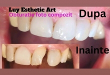 Medic Bun Campulung Muscel Protetica dentara Campulung Muscel -  Clinica Dr. Gupta