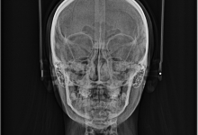 Medic Bun Craiova Radiologie Dentara Craiova - Maxx Dent