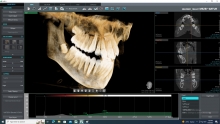 Medic Bun Zarnesti Radiologie Dentara Zarnesti - DIODENTA SRL