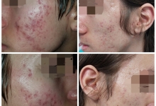 Medic Bun Campulung Muscel Spital-Clinica Privata Campulung Muscel - Clinica Dr. Gupta