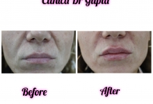 Medic Bun Campulung Muscel Spital-Clinica Privata Campulung Muscel - Clinica Dr. Gupta
