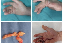 Medic Bun Pitesti Spital-Clinica Privata Pitesti - Clinica Dr. Gupta