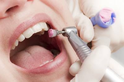periaj dentar sector 6
