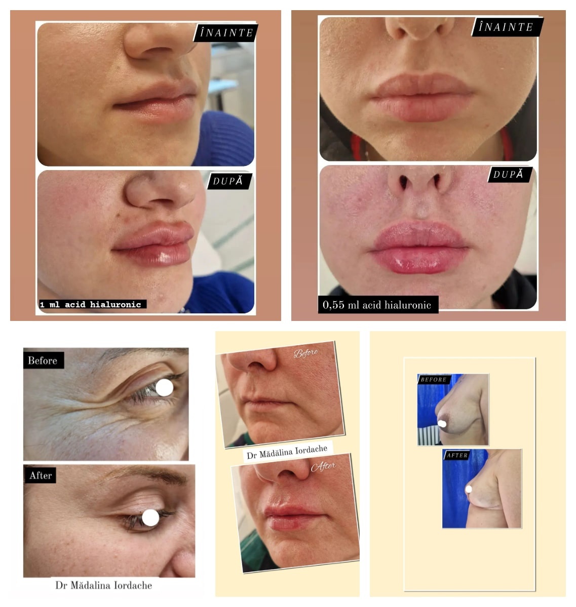chirurgie plastica pitesti