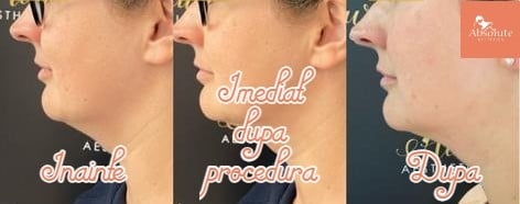 ultracellq+ galati